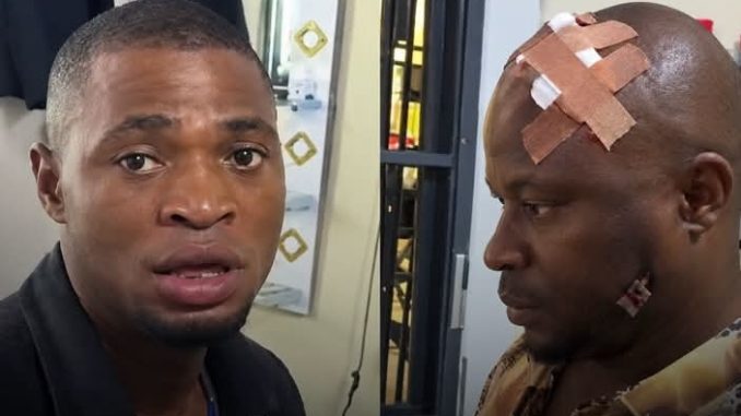 Tenant breaks landlord head in Edo